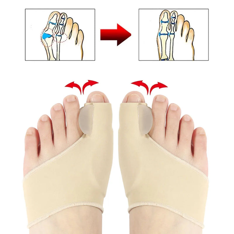 BunionEase™ - Orthopedic Bunion Sock